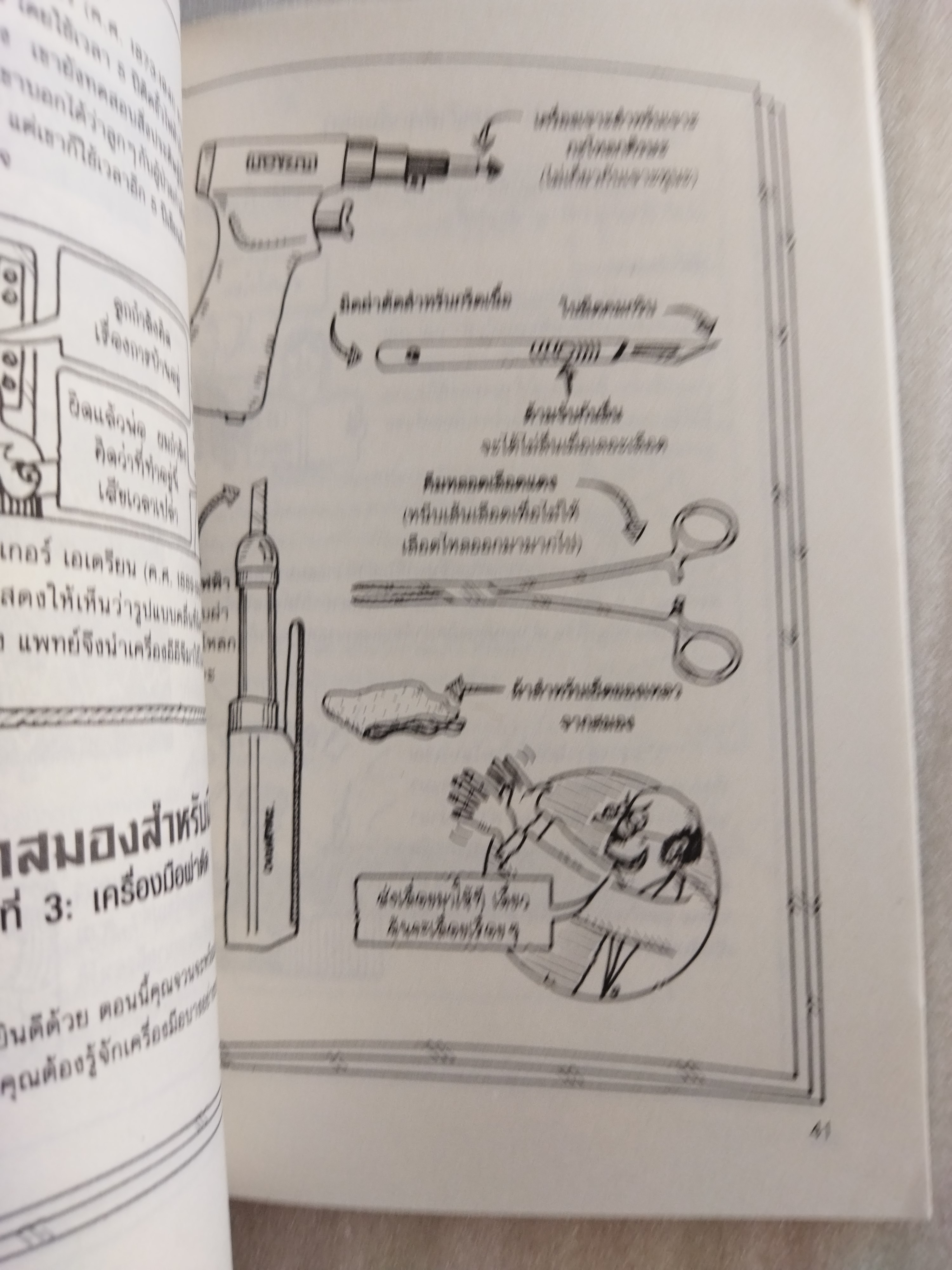 ผ่าสมองสยองเกล้า