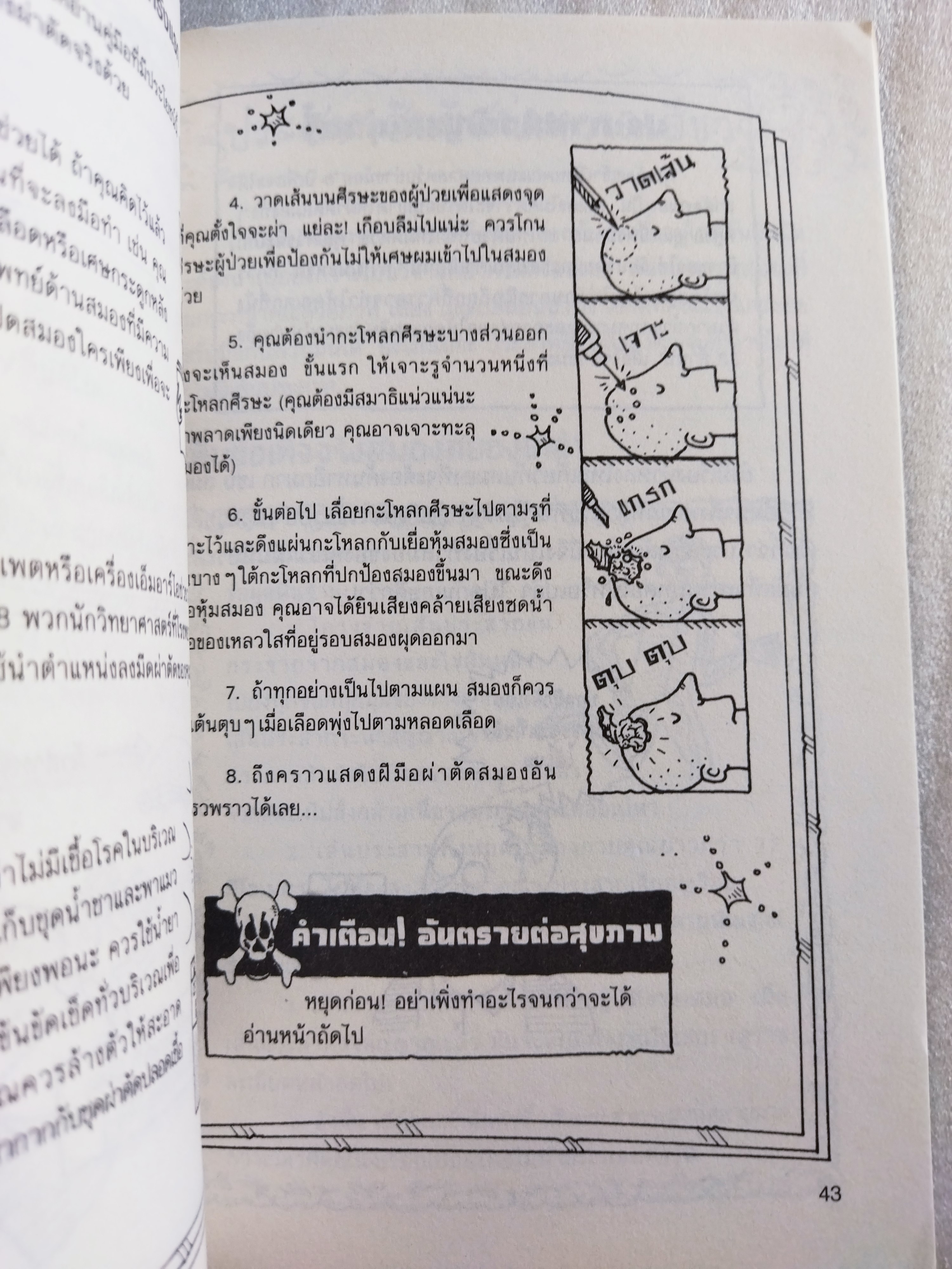 ผ่าสมองสยองเกล้า