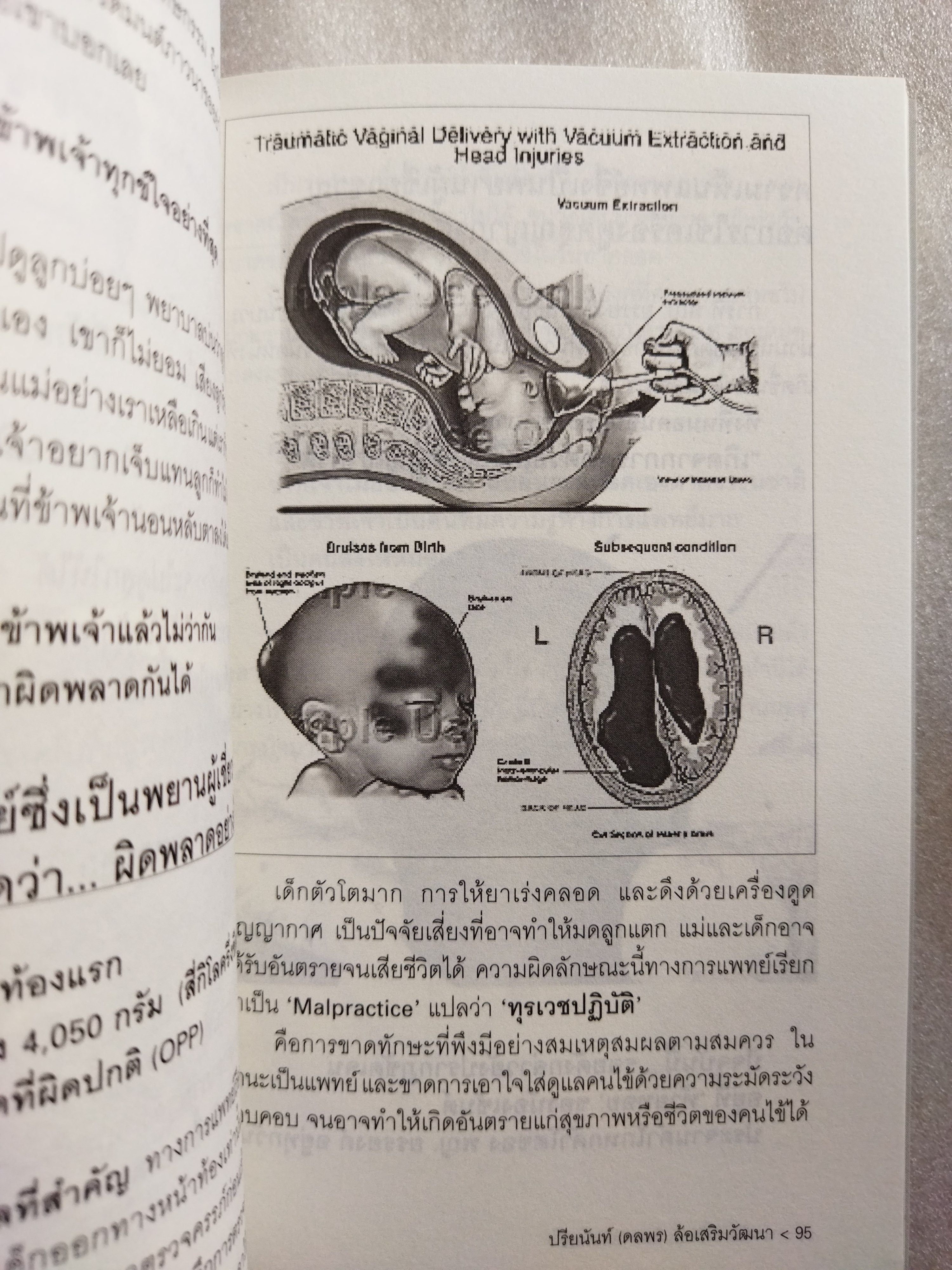 นางปีศาจร้ายในสายตาหมอ / ปรียนันท์